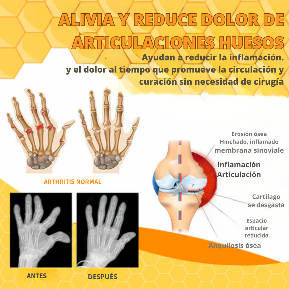 Si buscas el Alivio instantáneo para tus dolores musculares y articulares, esto es lo que necesitas